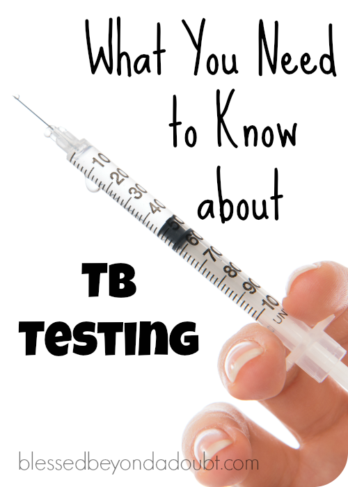 TB testing